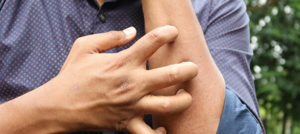 Psoriasis: causes and treatment